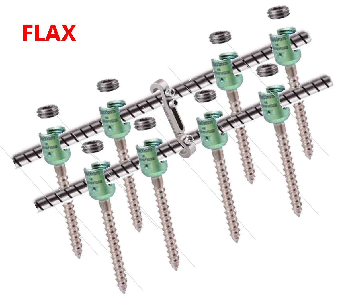 Транспедикулярна конструкція з гнучкими стрижнями FLAX Medical Concepr (8 гвинти)